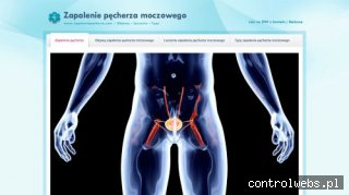 Zapalenie pęcherza