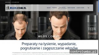 Łysienie
