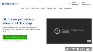 Uzupełnianie włosów