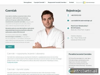 Wykryj Czerniaka