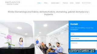 Dentysta stomatolog Kraków - Implantis