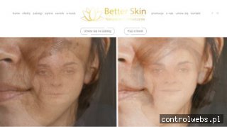 Facemodeling Kraków - Better Skin