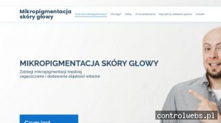 Mikropigmentacja skóry głowy mikropigmentacja.eu