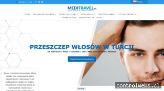 Przeszczep włosów w Turcji i operacje plastyczne