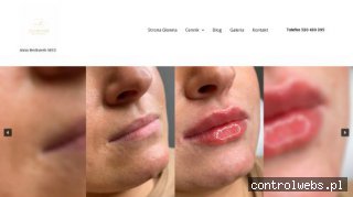 Wypełnienie zmarszczek