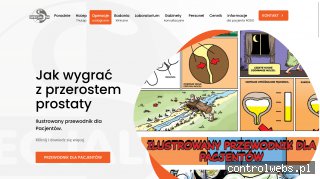 Laserowe usuwanie kamieni